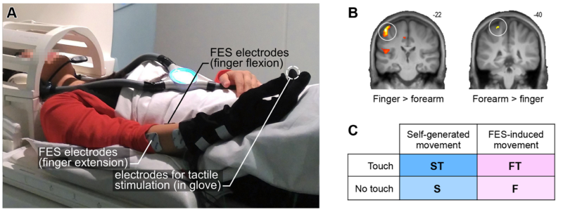 Pinpointing Agency and Realism in the Brain During Electrical Muscle Stimulation